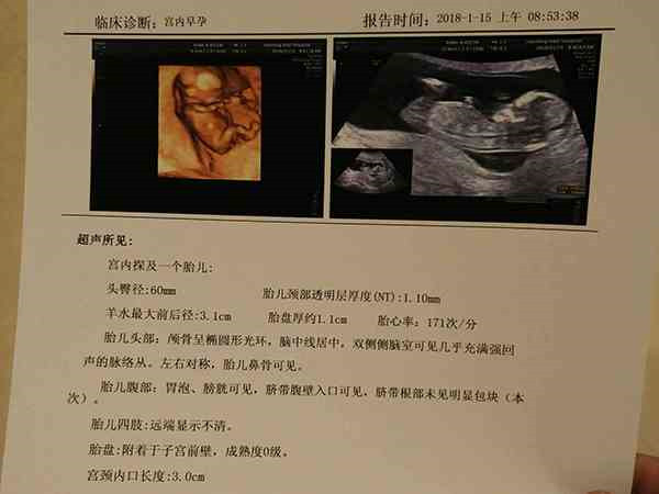 武汉第三代高科技医疗检测 1武汉健康医院做试管婴儿多少钱_3万能够成功吗_